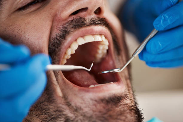 Best Dentist for Tooth Abscess  in Taylor, MI